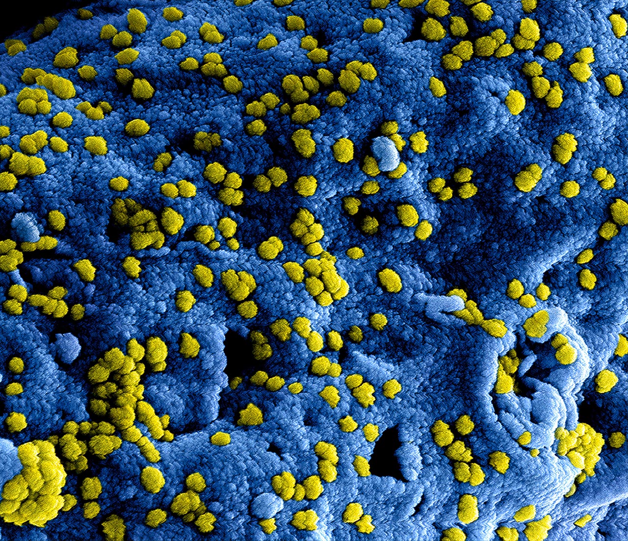 Featured image for “Coronavirus Employer Information Session”
